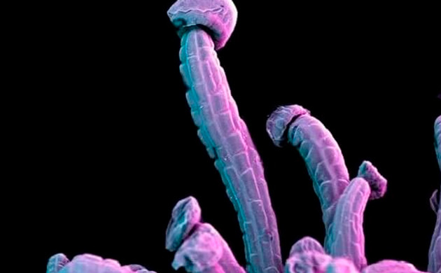 Отростки в форме гриба